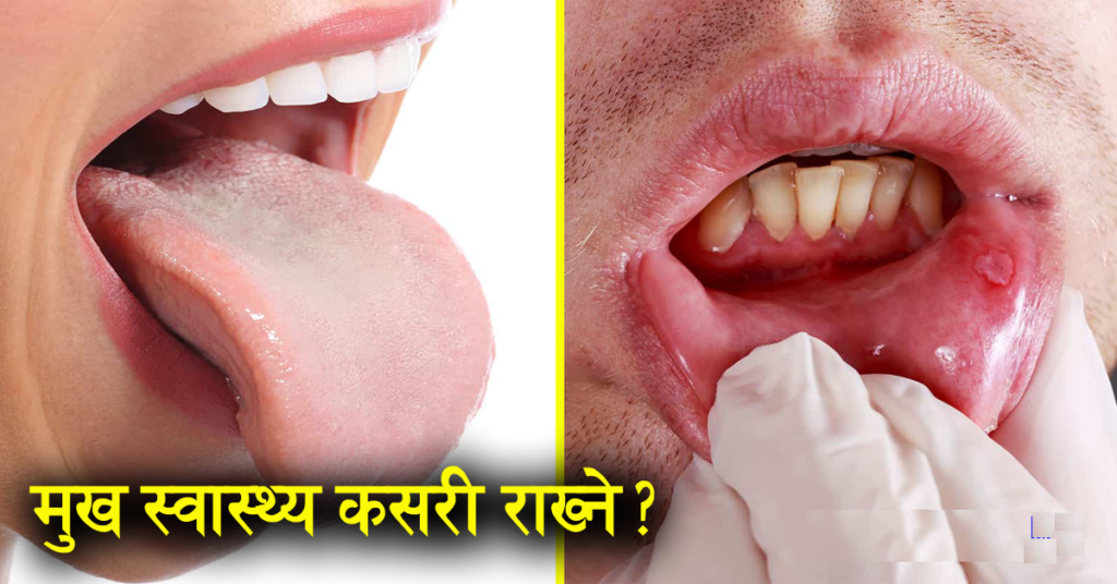 ख्याल गर्नुस् है मानव शरीरभित्र करीब ९० प्रतिशत रोग मुख स्वास्थ्य नहुँदा हुन्छ !