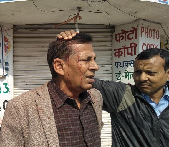 जनकपुरमा बन्द गराउँदै हिडेका पूर्व मन्त्री झाको टाउकोमा प्रहरीको लाठी, प्रहरीसंग झडप