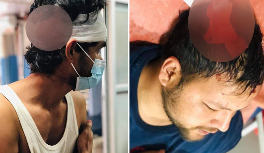 चितवनको रामपुर कृषि क्याम्पसमा अखिल क्रान्तिकारीको आक्रमणबाट नेविसंघका चार विद्यार्थी घाइते